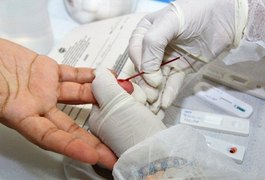 Sesau lança campanha para estímulo à testagem rápida de HIV