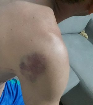 Homem é agredido por indivíduos após tentar evitar que grupo matasse cadela, em Taquarana