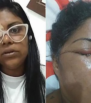 Mulher perde visão de um olho após agressor se irritar com samba em homenagem a Exu