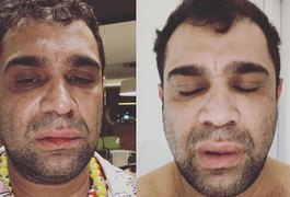 Ex-Pânico relata agressão após show: 'Homofobia e covardia'