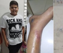 Menino de 12 anos morre após fraturar tornozelo no futebol e família acusa hospitais de negligência: 'dor e revolta'