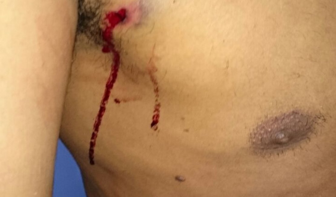 Agente penitenciário é baleado ao chegar em casa