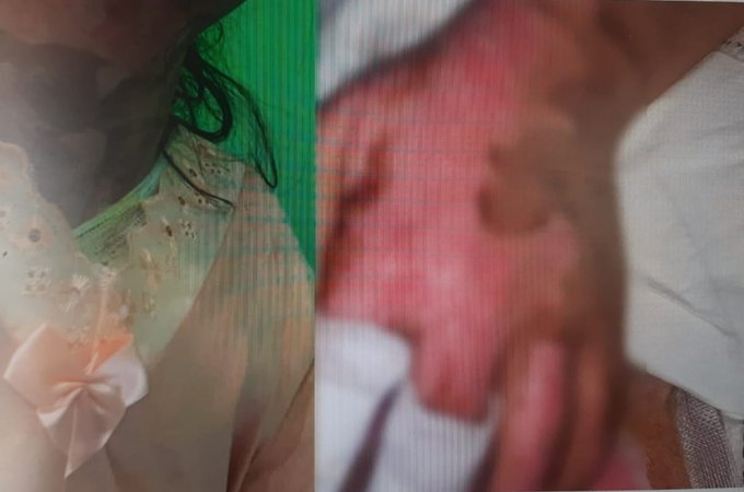 Polícia Civil investiga tentativa de feminicídio, por esganadura, contra adolescente de 16 anos, no Sertão alagoano