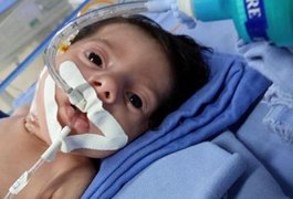 Bebê de apenas 3 meses diagnosticado com fibrose cística é transferido para a Santa Casa, em Maceió