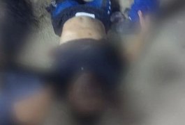 Atentado a bala deixa homem ferido em chácara no Sertão alagoano