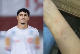 Jogador de futebol é suspeito de agredir jovem e ameaçar ex durante festa