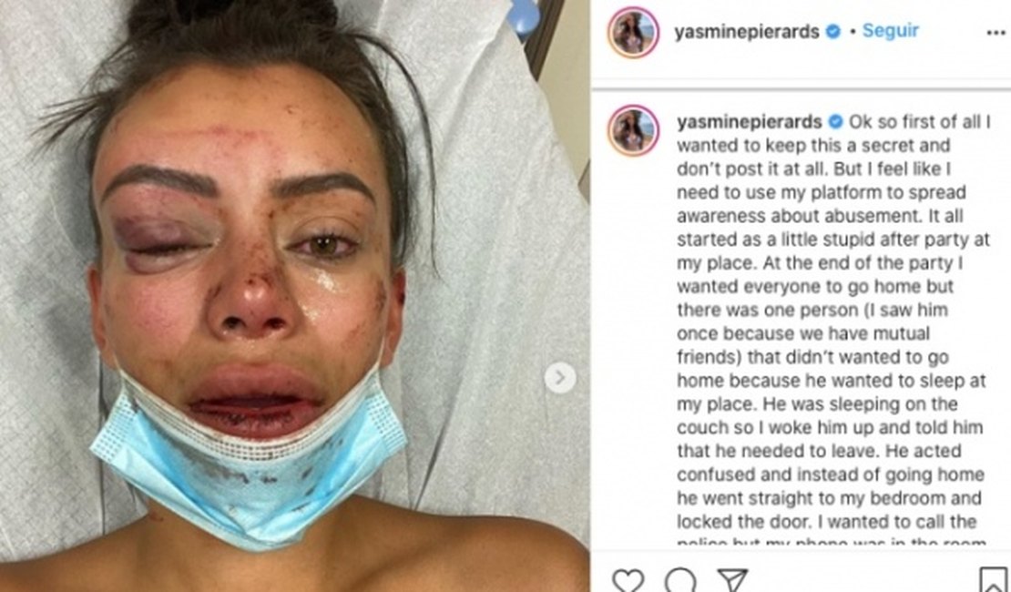 Modelo do 'De Férias com o Ex' é agredida durante festa em casa