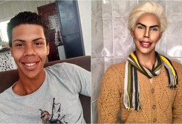 Garoto de 16 anos sonha em fazer 42 cirurgias para ficar idêntico ao ‘Ken’