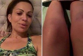 Solange Almeida cai no palco e fica ferida durante show no Rio Grande do Norte