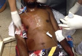 Homem fica gravemente ferido após ser baleado em Teotônio Vilela