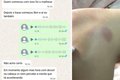 Adolescente de 17 anos denuncia estupro coletivo em churrasco com amigos em MG