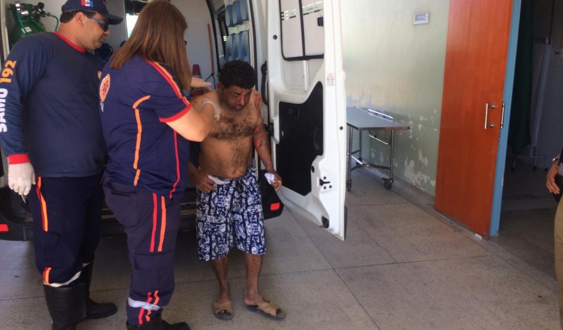 Mulher joga álcool no marido e ateia fogo, em Arapiraca