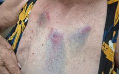 Idosa foi agredida por sobrinha que é médica, em Arapiraca
