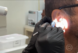 Pesquisa de universidade brasileira descobre que cera de ouvido pode ajudar a detectar câncer