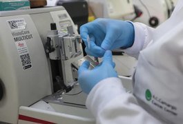 Cura de câncer de próstata pode chegar a até 98%