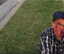 Mulher espanca idoso de 92 anos com bloco de concreto nos EUA: 'Volte para o México'