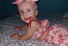 Em Alagoas: bebê de 1 ano precisa de ajuda para cirurgia de catarata