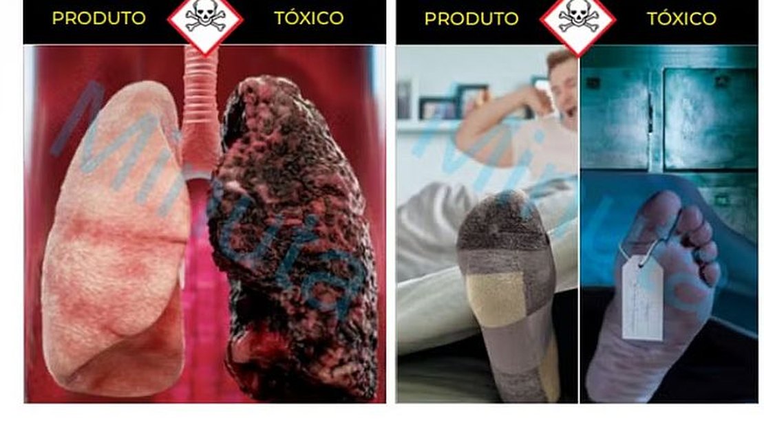 Anvisa aprova novas imagens de advertência para embalagens de cigarro; veja