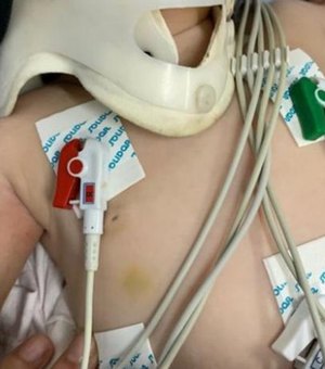 Pai de bebê internada com mais de 30 lesões é preso; criança já respira sem ajuda de aparelhos