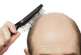 Remédio para artrite faz crescer cabelo – e muito – em homem careca