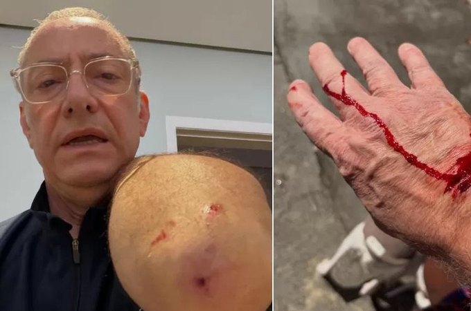 Jornalista da Globo é atacado por pitbull sem guia