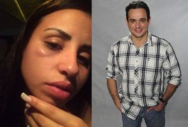 Modelo acusa porteiros de agressão a mando de ex-marido ator