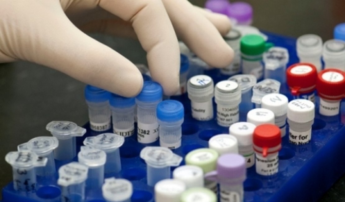 Instituto de Criminalística de Alagoas terá laboratório de DNA próprio até dezembro