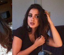 Fãs desconfiam que Anitta tenha feito preenchimento labial