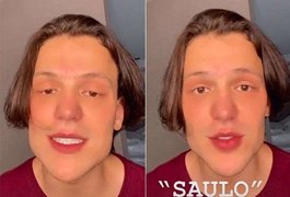 Internautas apontam harmonização facial de Saulo Poncio e cantor vira meme na internet