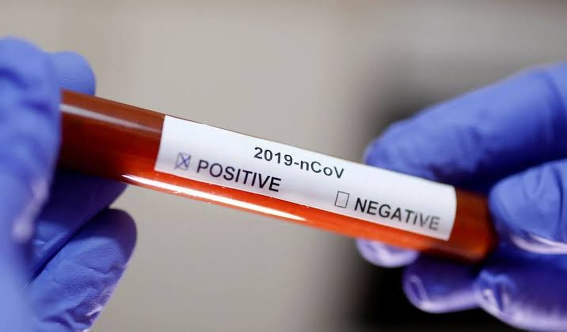 Covid-19: Arapiraca registra 8.202 casos e mais um óbito nesta quinta (30)
