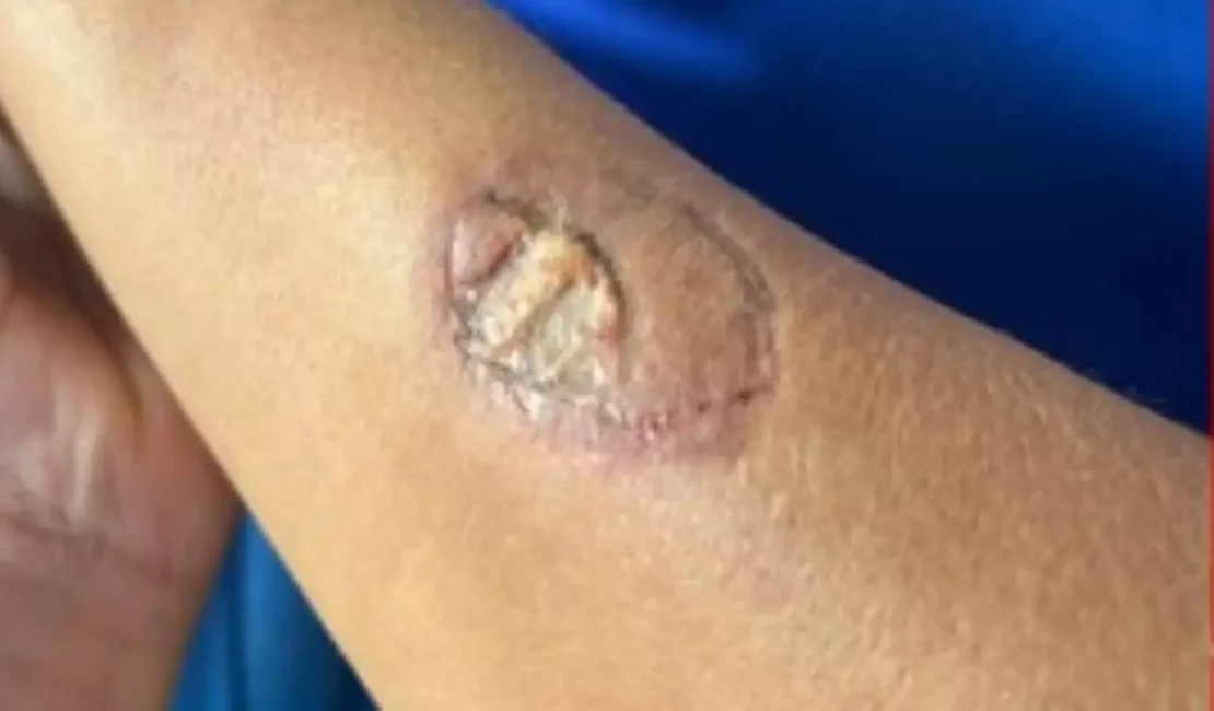 Mãe de aluno morde vice-diretora e funcionários de escola após discussão por uso de uniforme, diz TV