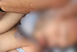 Ciclista é atingido por caminhão enquanto seguia pela AL-220, em Arapiraca; estado de saúde da vítima é grave