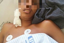 Menor suspeito de assalto a Caixa Aqui em Santana do Ipanema está internado na UEA