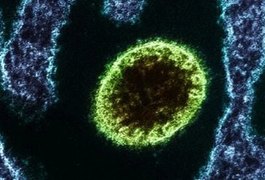 Surto de vírus letal Nipah deixa Índia em alerta; conheça os riscos do microrganismo