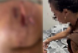 Dentista que usou silicone industrial e provocou lesão em pacientes é presa pela Polícia Civil, em Arapiraca