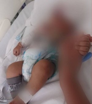 Bebê de quase dois meses morre após ser atingido por celular no rosto, arremessado pelo pai