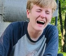 Adolescente de 17 anos morre durante cirurgia de remoção de siso nos EUA