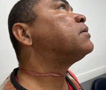 Mototaxista quase é degolado por fio na estrada em Marechal Deodoro