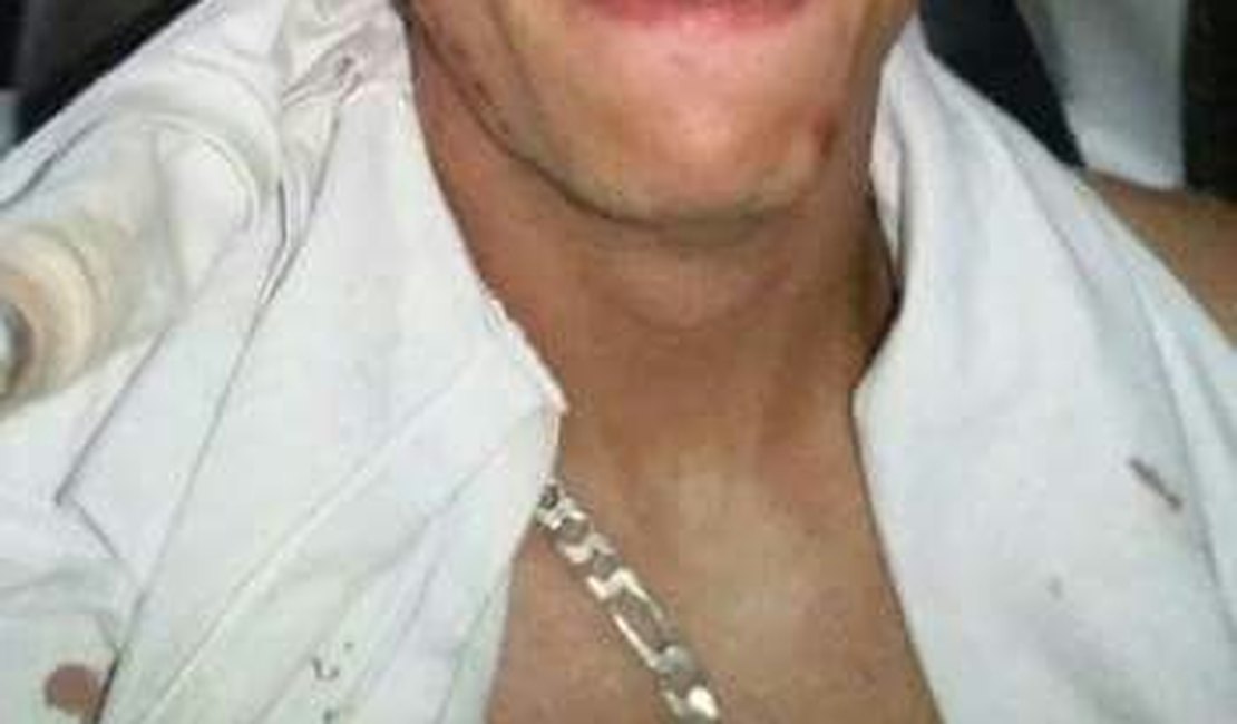 Goleiro alagoano fica ferido durante assalto em Marechal Deodoro