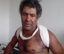 'Pastel do Brega' sofre outro acidente de moto e fratura a clavícula