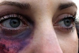 Mulheres vítimas de violência podem fazer cirurgia plástica pelo SUS