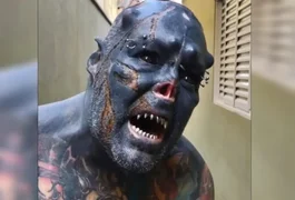 Após mutilar o nariz e a orelha, colocar presas de vampiro e 'chifres', homem decide queimar o rosto: 'Lindo'