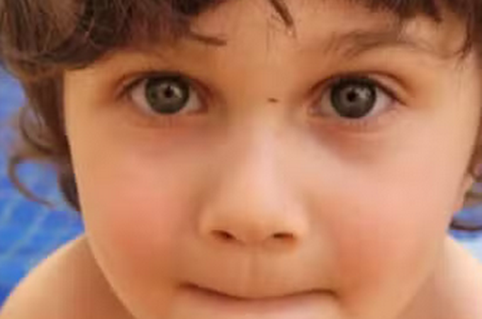 Menino de 4 anos que sobreviveu à queda do 10º andar de prédio quebrou as duas pernas