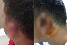 Homem tem parte da orelha arrancada ao ser mordido em briga e pedaço é comido por gaivota