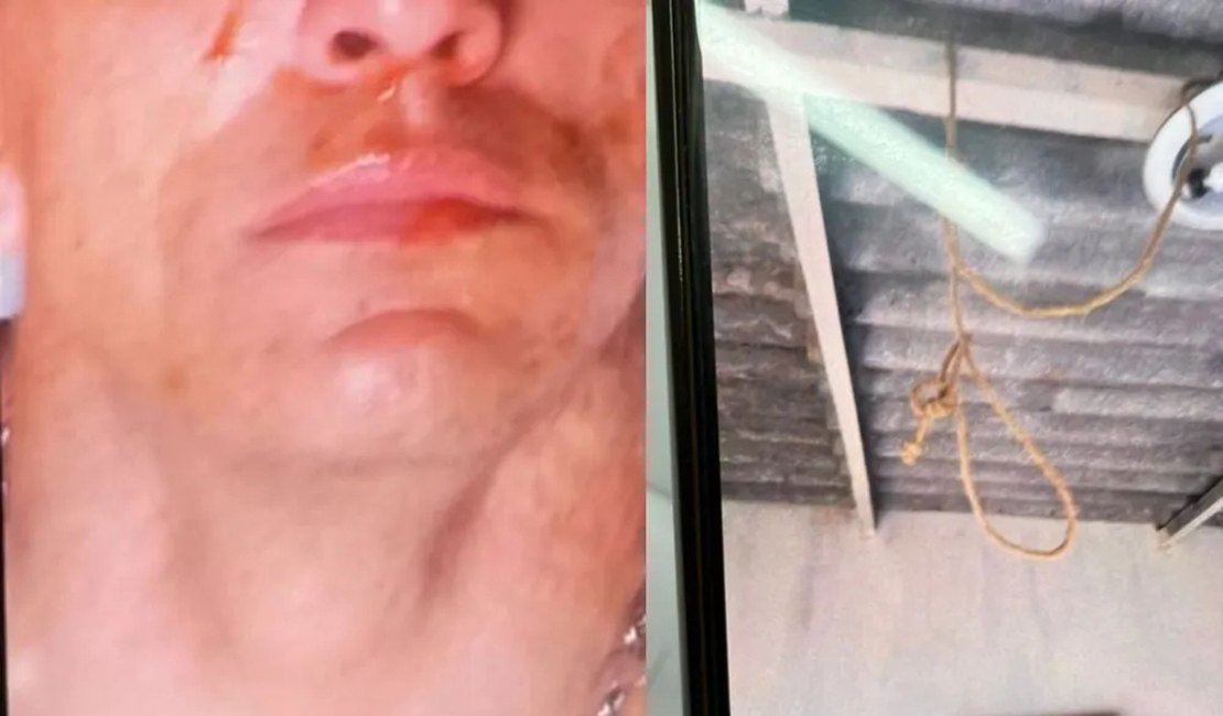 Homem simula tentativa de suicídio para tentar comover namorada após ela o denunciar por violência doméstica