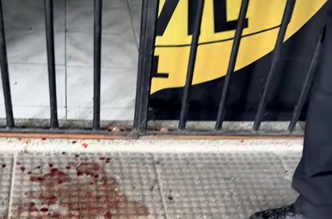 Mulher é agredida pelo companheiro e procura delegacia com mão sangrando em Maceió