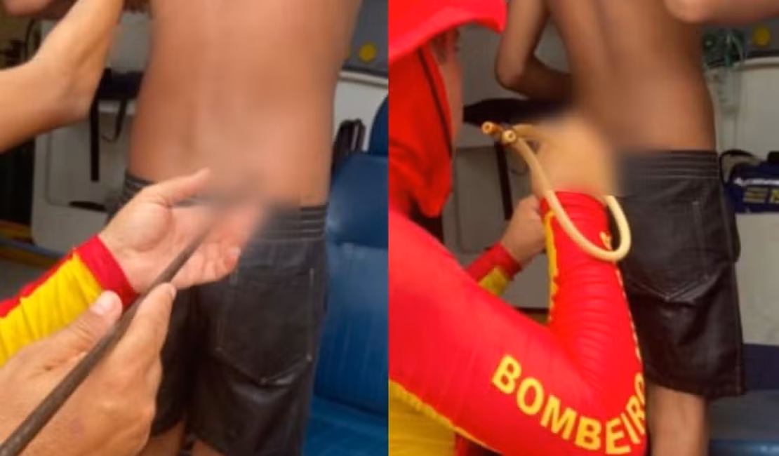 Adolescente é atingido por arpão durante pesca na Praia do Francês, em Marechal Deodoro