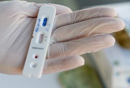 Alagoas registra 96 casos a mais de Covid-19 com relação ao último boletim