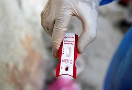 Alagoas registra 538 casos de covid-19 e 13 mortes no boletim desta segunda-feira (3)
