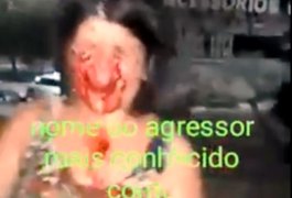 Alagoana é espancada e tem o rosto desfigurado por morador de rua em Fortaleza